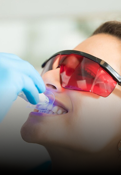Teeth Whitening