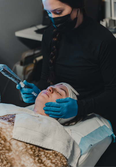 Microneedling