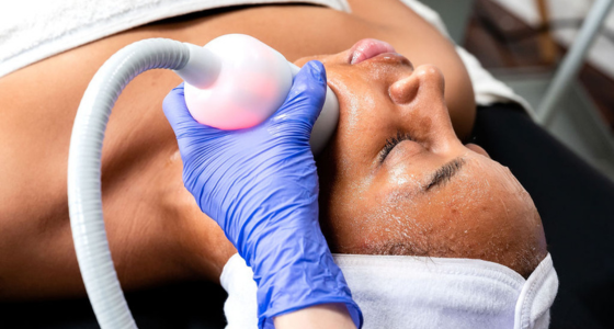 Cryo-Facial