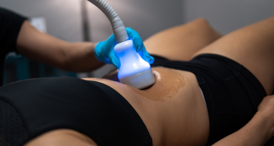 Body Cryo-Tone