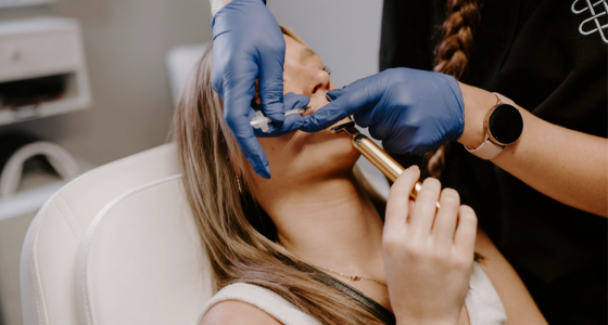 Lip Filler 0.55mL