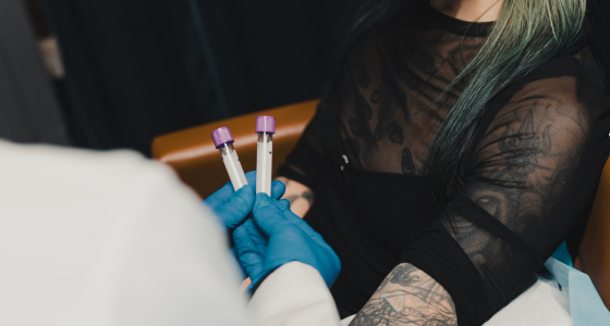 PRP Microneedling Facial