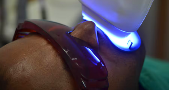 Teeth Whitening