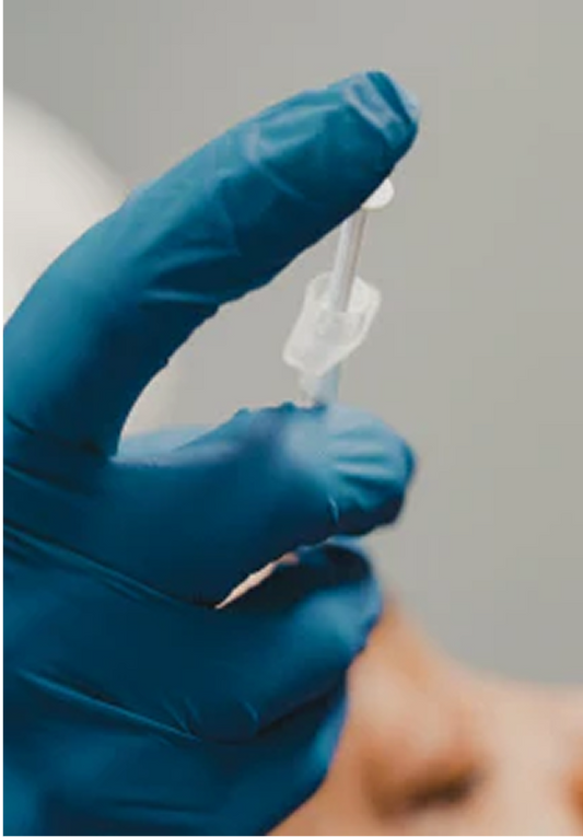 Microneedling Before and After: What Results to Expect After Each Session