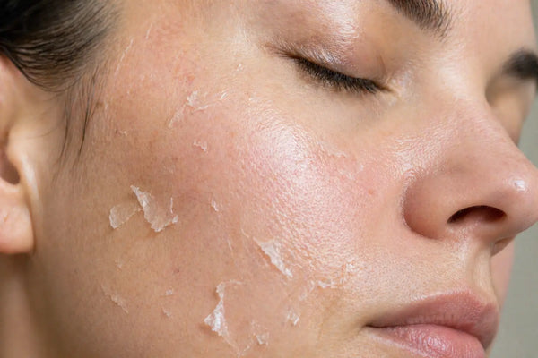3-PACK VI PEEL (FACE)